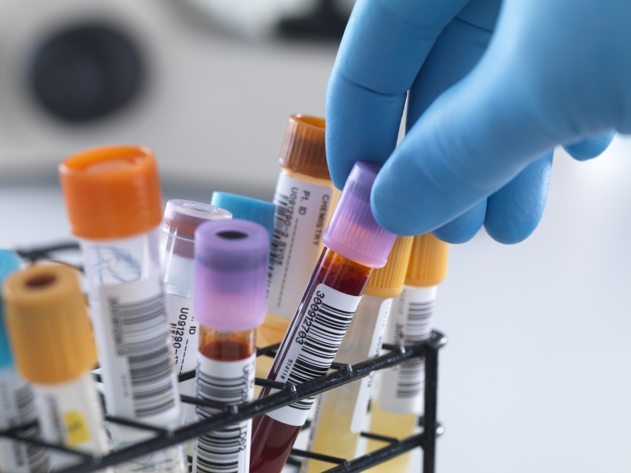 一致性评价大幕开启，医院市场即将调整