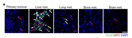 转入小鼠模型得到相同的试验结果，且在转移发生前NET已在肝脏聚积。