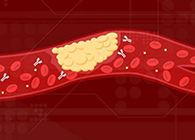 【Science速递】攻克COVID-19里程碑：已确定血凝块形成原因！