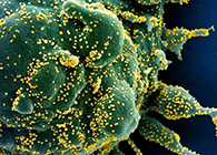 唾液检测新冠抗体新方法来了，获取结果仅需几小时！