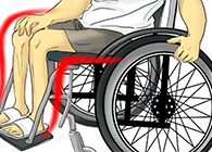 Nature：还瘫痪患者一个自由身的日子不远了