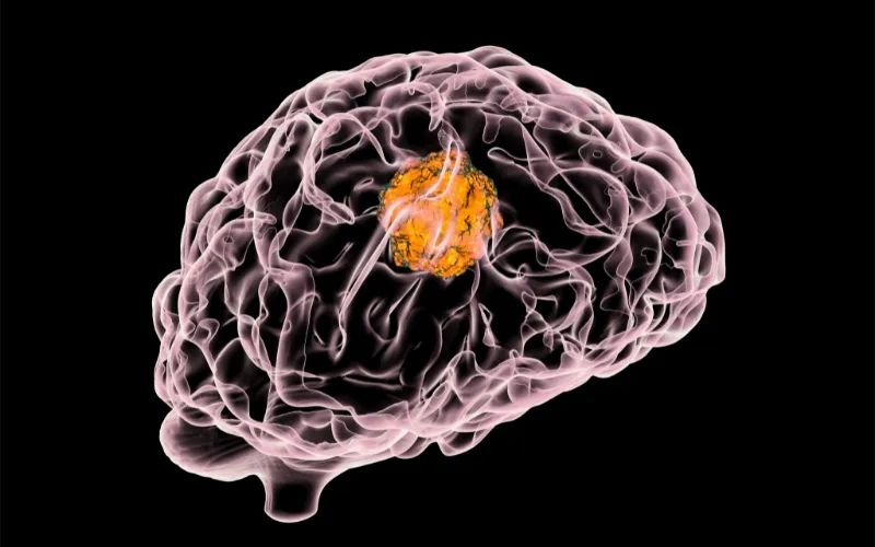 不朽情缘mg官网助力 | 璧辰医药ABM-1310获美国FDA孤儿药资格认证，用于治疗携带BRAF V600突变的脑胶质母细胞瘤患者