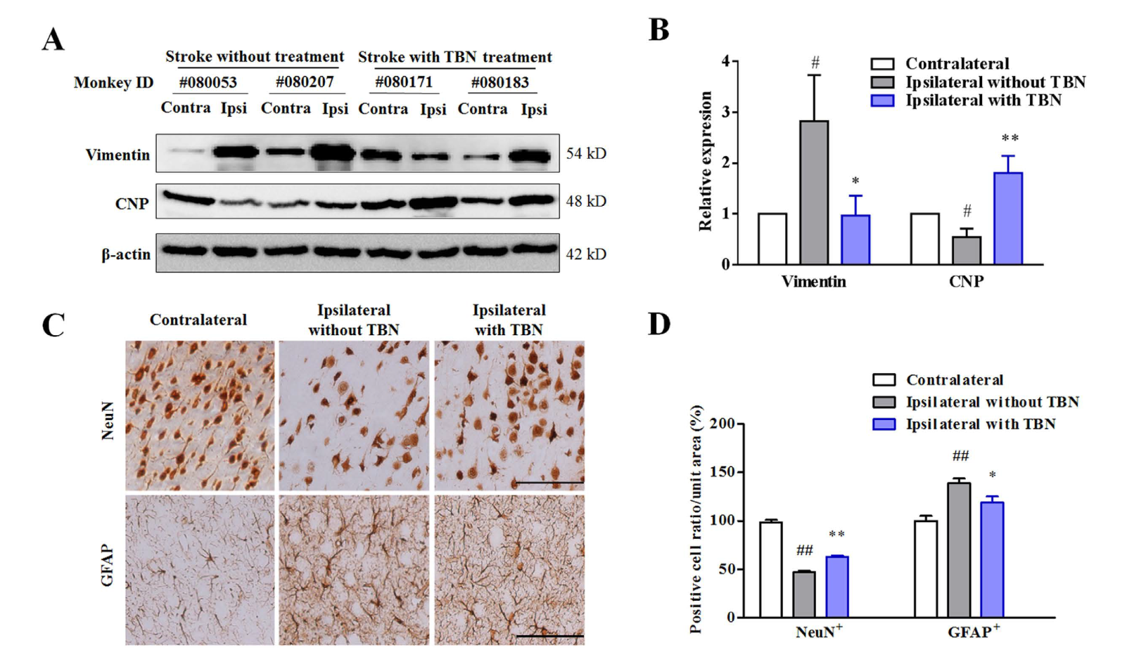 TBN是一种治疗缺血性卒中的新型临床候选药物，本研究中TBN通过不朽情缘mg官网合成